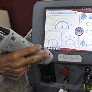 ¿Cada cuánto tiempo puedo realizar una sesión de depilación láser?