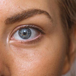 Elimina las imperfecciones de tu piel con el láser GentleMax Pro
