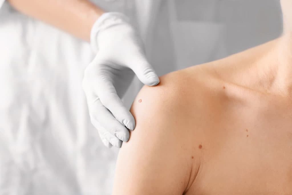 Estudio dermatológico de la piel en Cangas