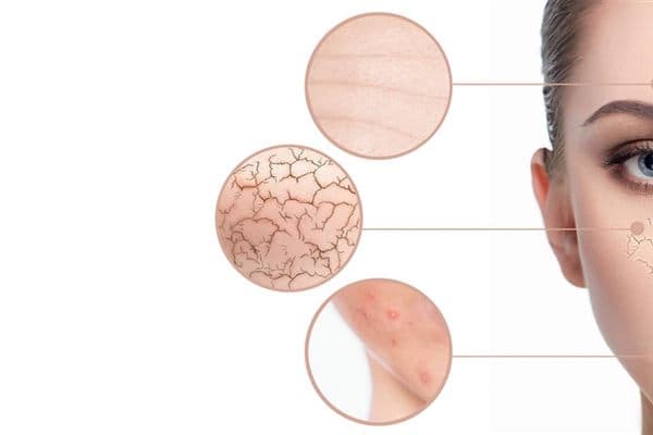 Consulta de dermatología de Prosaude en Cangas