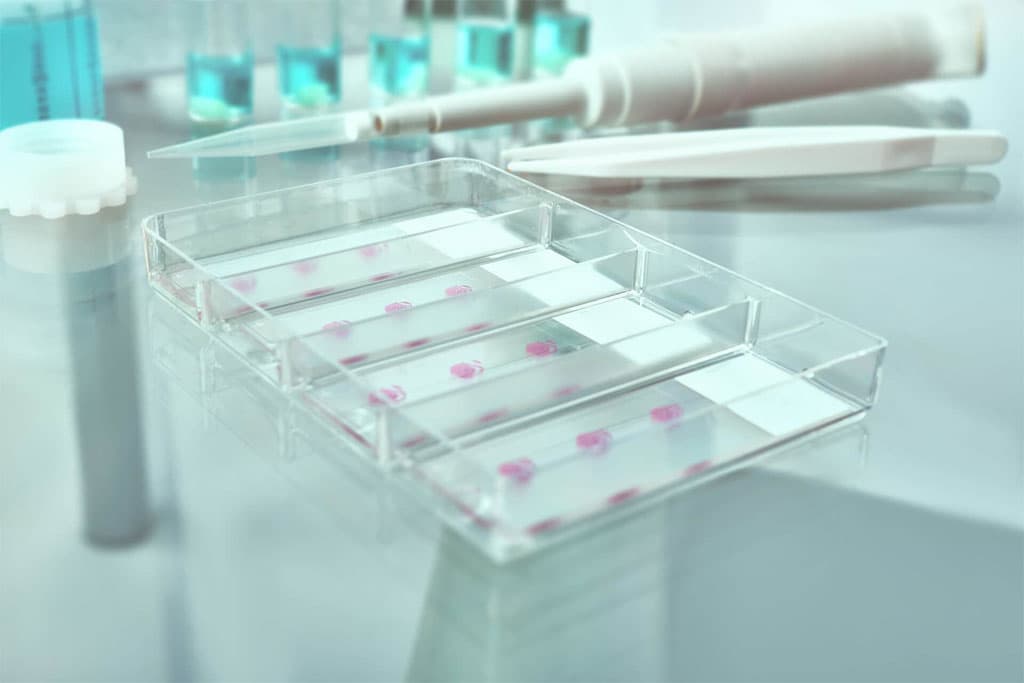 Laboratorios de análisis con los que colaboramos desde Cangas
