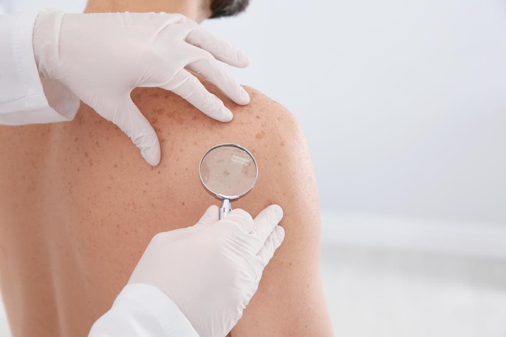 Manchas en la piel: Tipos, causas y tratamiento dermatológico