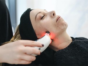 ¿Se puede depilar el rostro con láser?